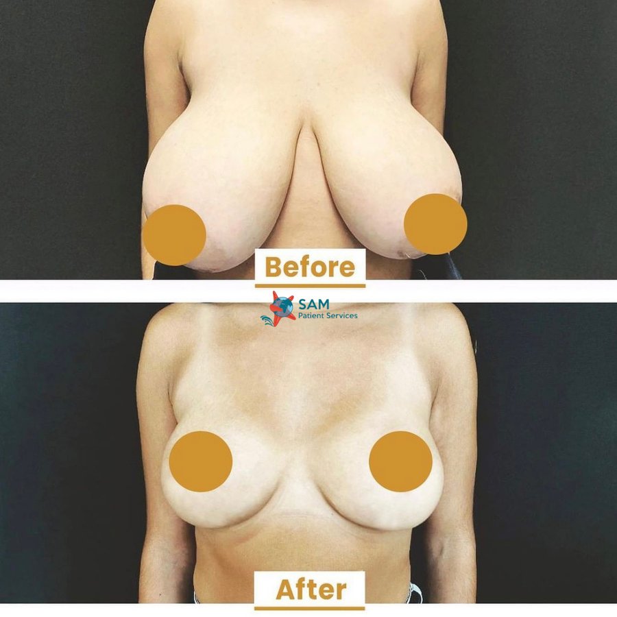 SAM Patient Services - Plastic Surgery - SAM Patient Services - Plastic Surgery