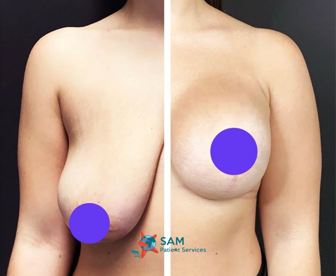 SAM Patient Services - Plastic Surgery - SAM Patient Services - Plastic Surgery