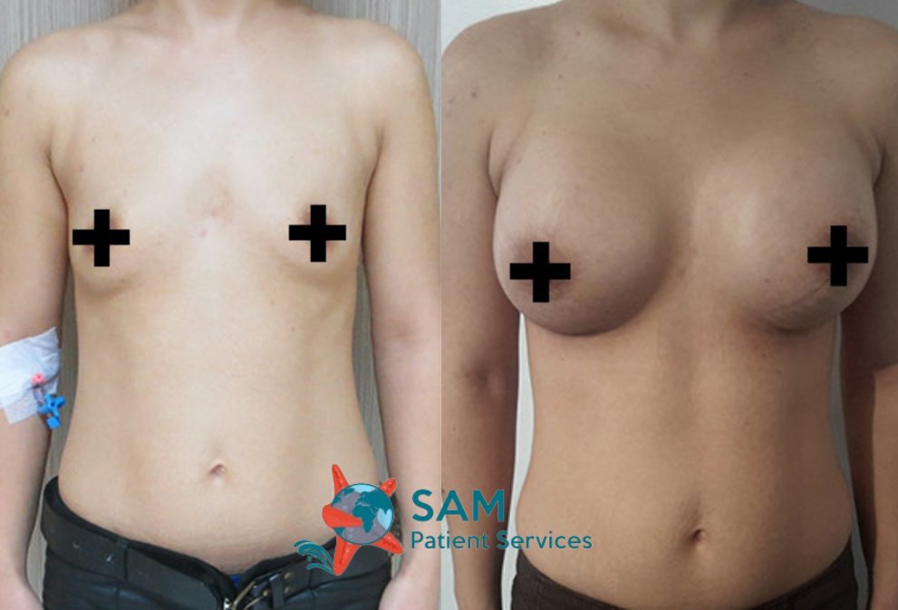SAM Patient Services - Plastic Surgery - SAM Patient Services - Plastic Surgery