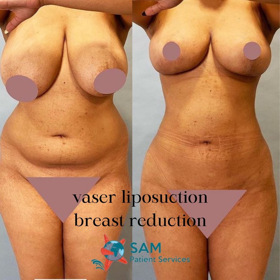 SAM Patient Services - Plastic Surgery - SAM Patient Services - Plastic Surgery