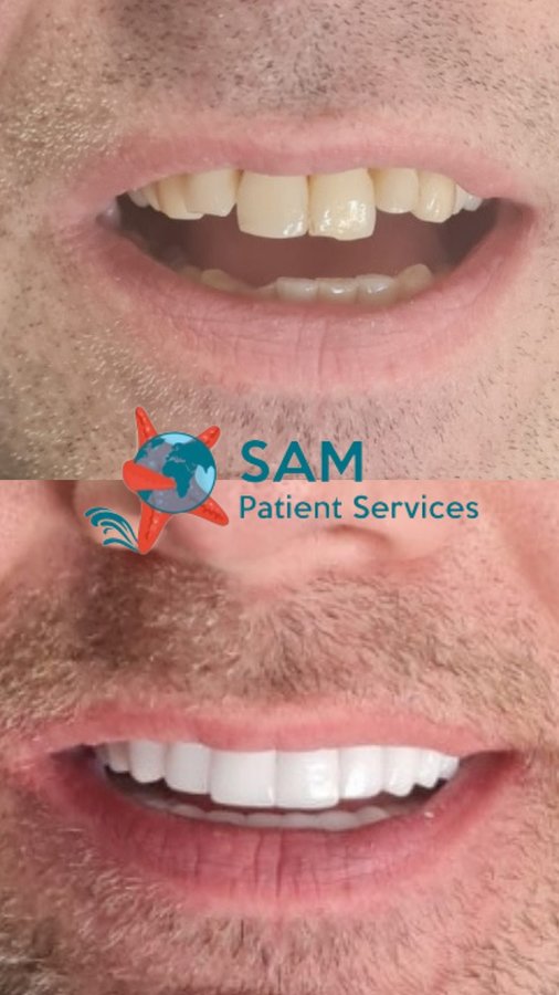 SAM Patient Services - SAM Patient Services