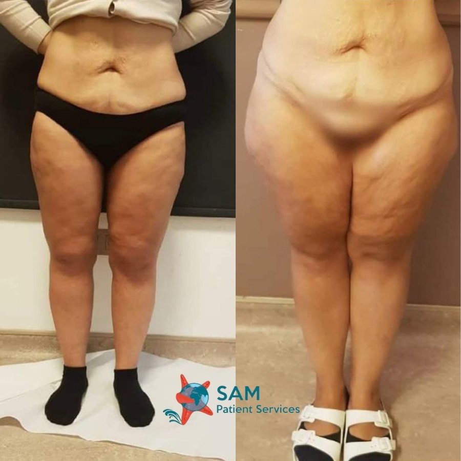 SAM Patient Services - SAM Patient Services