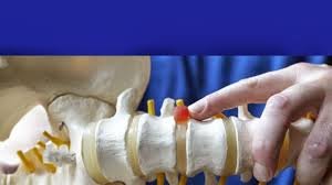 San Diego Integrative Spine Center - San Diego Integrative Spine Center