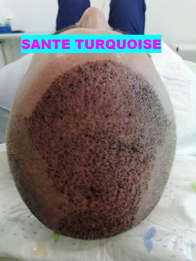 Santé Turquoise - Santé Turquoise
