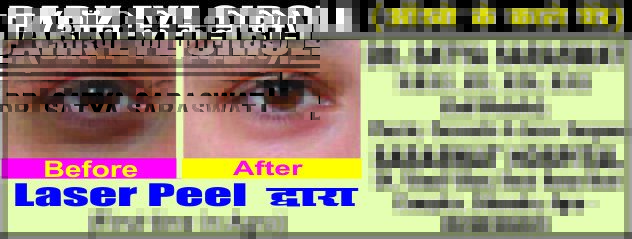 Saraswat Hospital -Cosmoworld Clinics(Agra) - Saraswat Hospital -Cosmoworld Clinics(Agra)