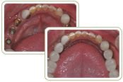 مستشفى سارافانا لطب الأسنان - Saravana Dental Hospital