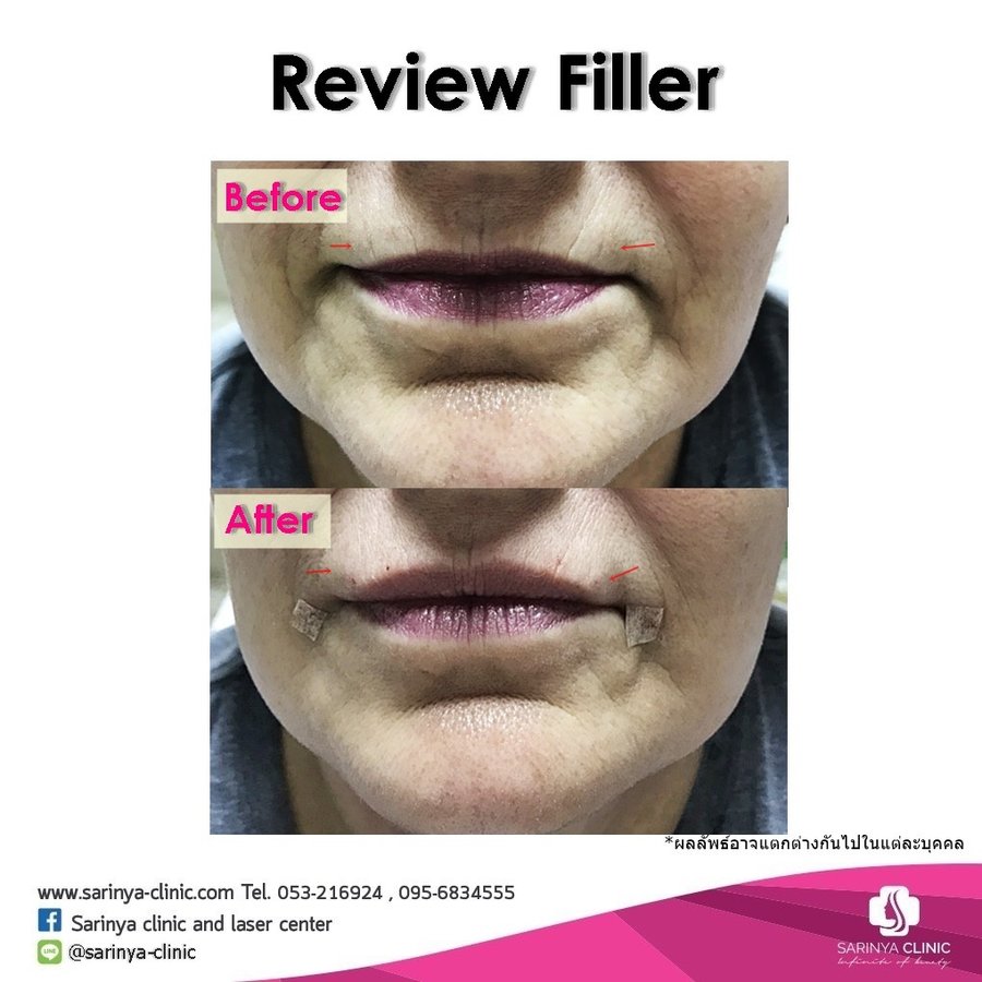 Sarinya Clinic- Chiang Mai Thailand - Sarinya Clinic- Chiang Mai Thailand