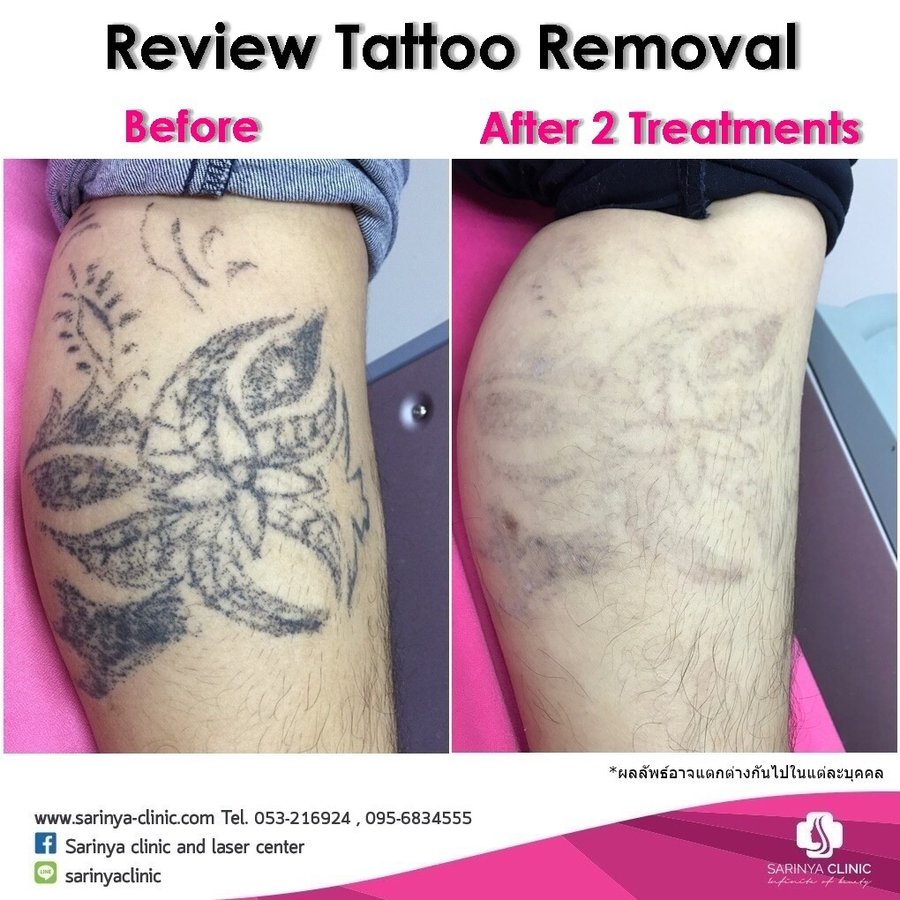 Sarinya Clinic- Chiang Mai Thailand - Sarinya Clinic- Chiang Mai Thailand