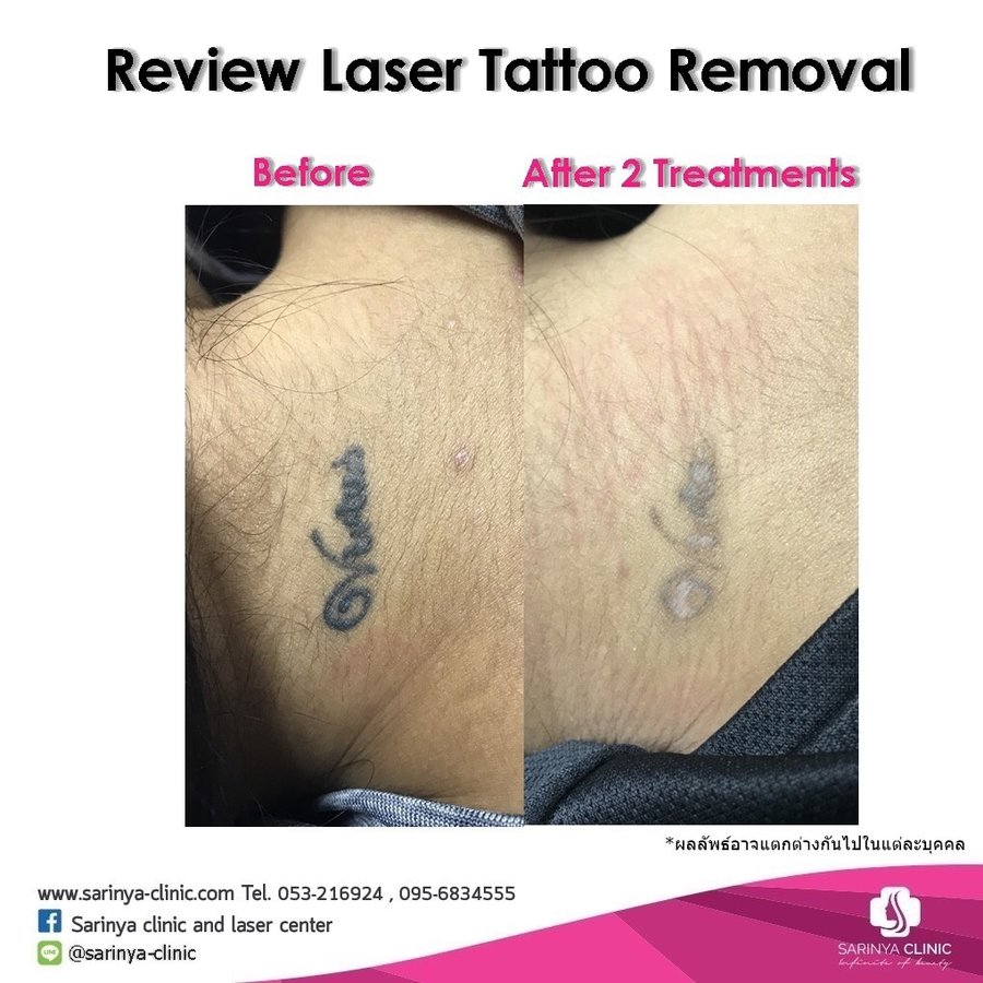 Sarinya Clinic- Chiang Mai Thailand - Sarinya Clinic- Chiang Mai Thailand