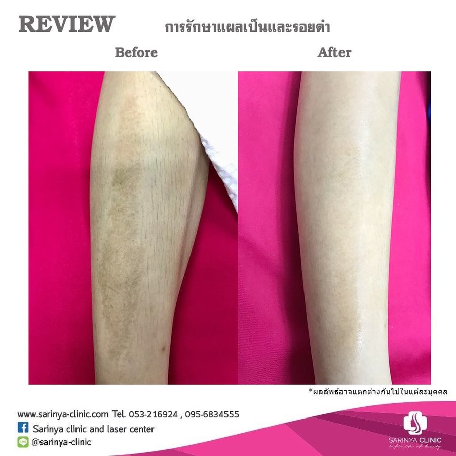 Sarinya Clinic- Chiang Mai Thailand - Sarinya Clinic- Chiang Mai Thailand