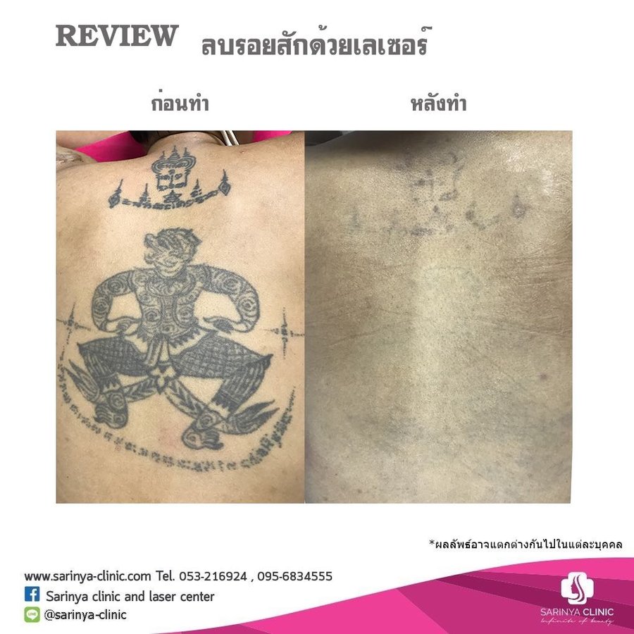 Sarinya Clinic- Chiang Mai Thailand - Sarinya Clinic- Chiang Mai Thailand