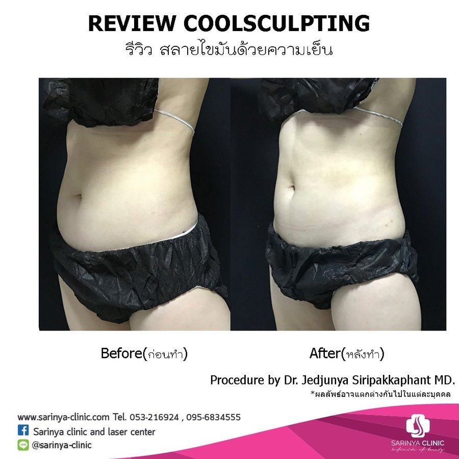 Sarinya Clinic- Chiang Mai Thailand - Sarinya Clinic- Chiang Mai Thailand