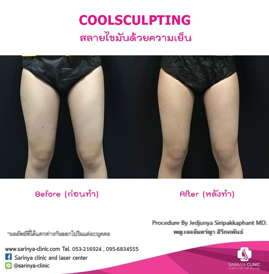 Sarinya Clinic- Chiang Mai Thailand - Sarinya Clinic- Chiang Mai Thailand