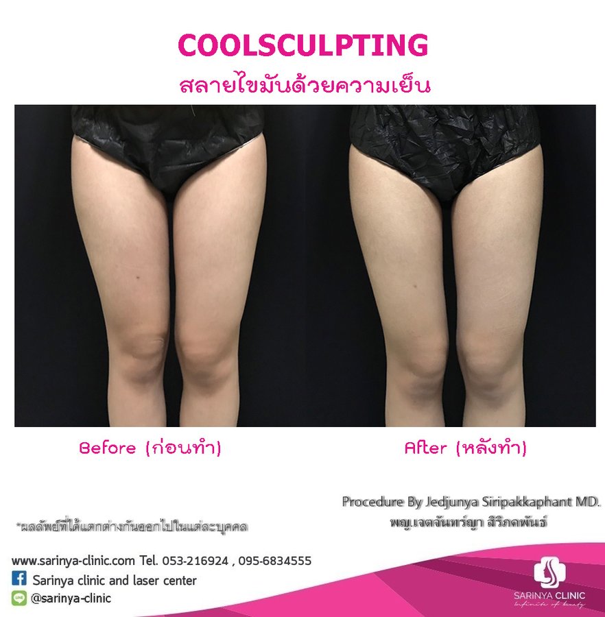 Sarinya Clinic- Chiang Mai Thailand - Sarinya Clinic- Chiang Mai Thailand