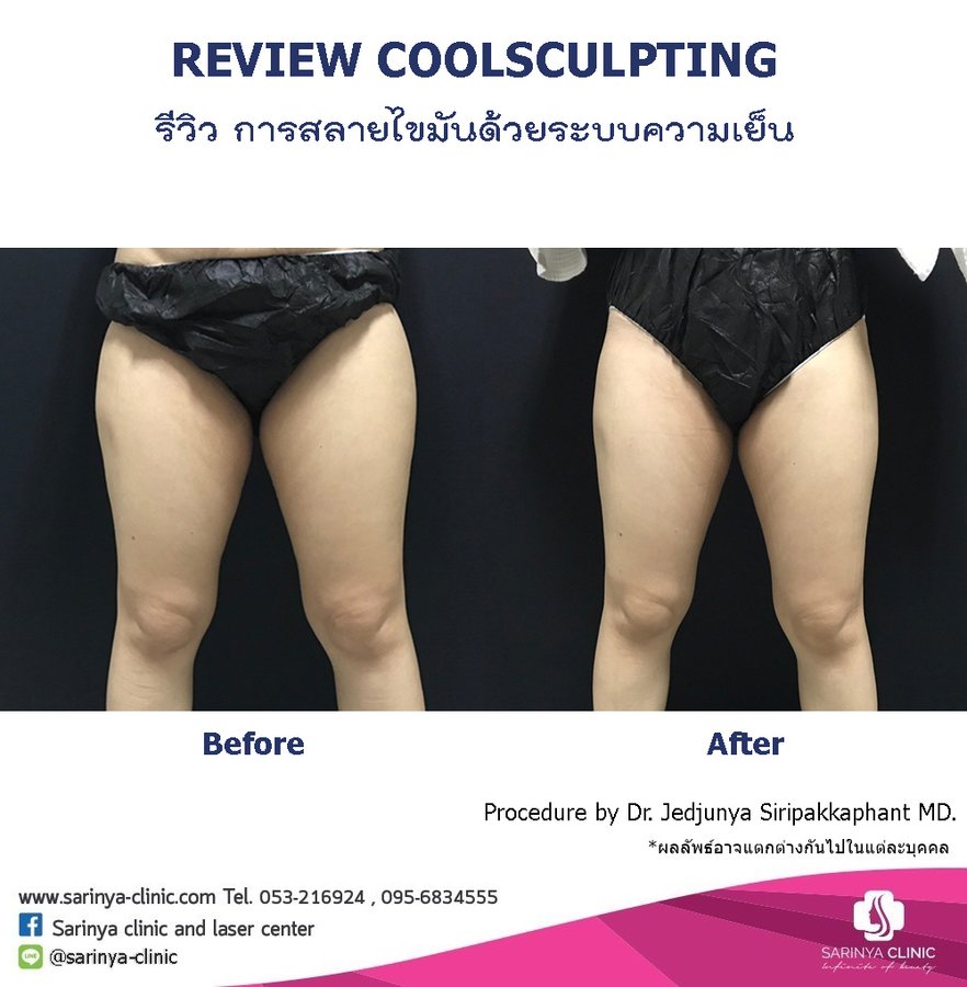 Sarinya Clinic- Chiang Mai Thailand - Sarinya Clinic- Chiang Mai Thailand