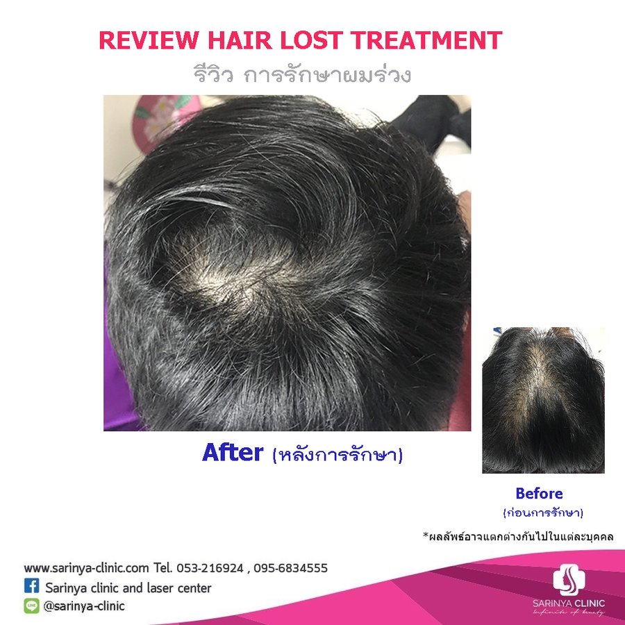 Sarinya Clinic- Chiang Mai Thailand - Sarinya Clinic- Chiang Mai Thailand