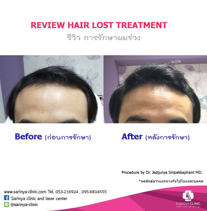 Sarinya Clinic- Chiang Mai Thailand - Sarinya Clinic- Chiang Mai Thailand