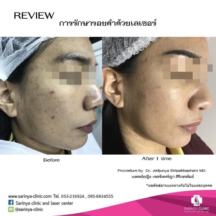 Sarinya Clinic- Chiang Mai Thailand - Sarinya Clinic- Chiang Mai Thailand