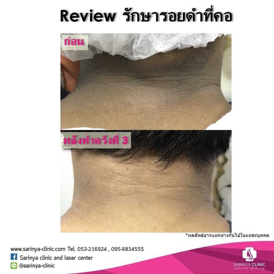 Sarinya Clinic- Chiang Mai Thailand - Sarinya Clinic- Chiang Mai Thailand
