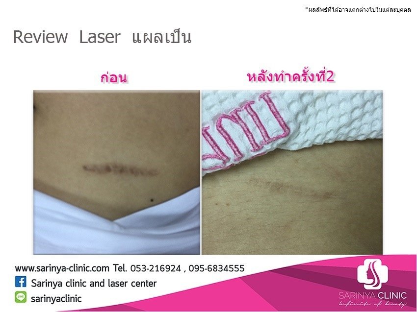 Sarinya Clinic- Chiang Mai Thailand - Sarinya Clinic- Chiang Mai Thailand