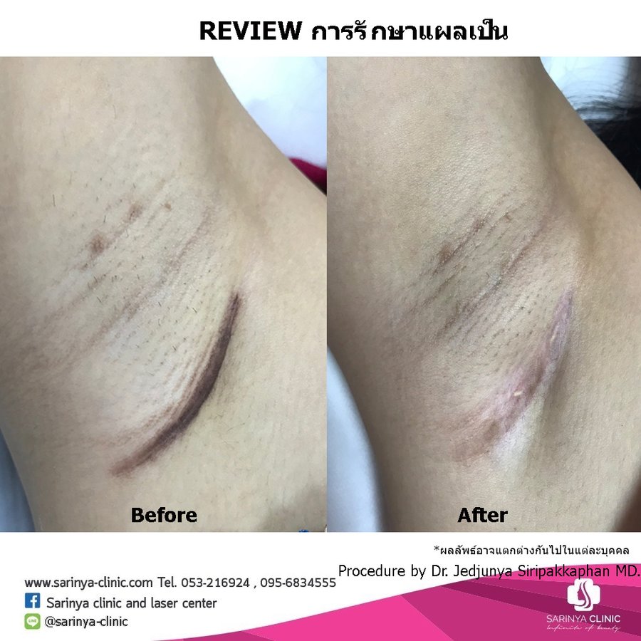 Sarinya Clinic- Chiang Mai Thailand - Sarinya Clinic- Chiang Mai Thailand