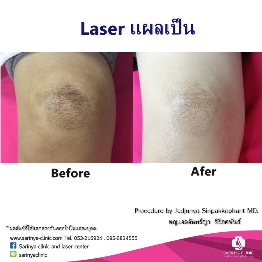 Sarinya Clinic- Chiang Mai Thailand - Sarinya Clinic- Chiang Mai Thailand