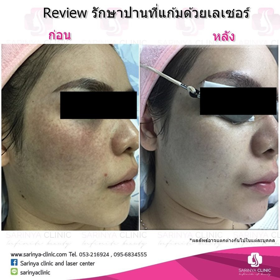 Sarinya Clinic- Chiang Mai Thailand - Sarinya Clinic- Chiang Mai Thailand