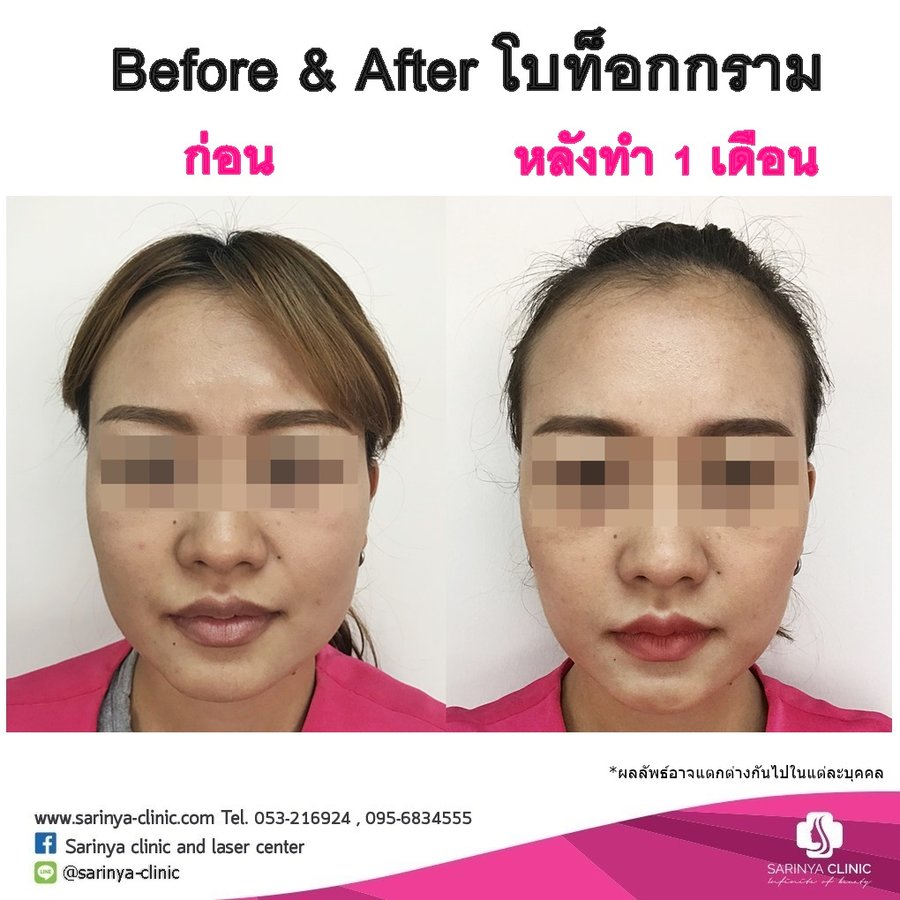 Sarinya Clinic- Chiang Mai Thailand - Sarinya Clinic- Chiang Mai Thailand