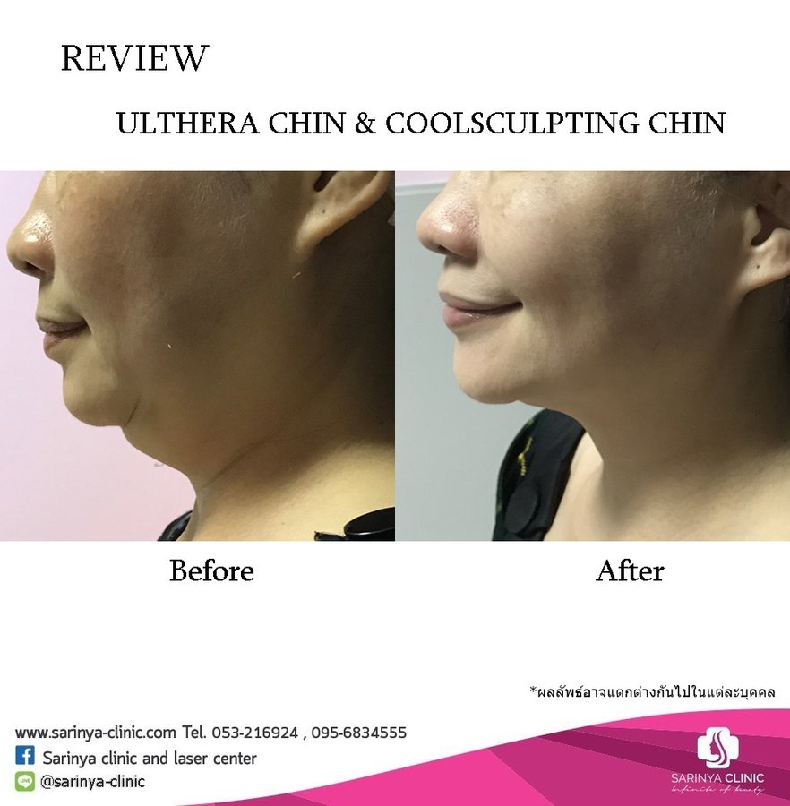 Sarinya Clinic- Chiang Mai Thailand - Sarinya Clinic- Chiang Mai Thailand