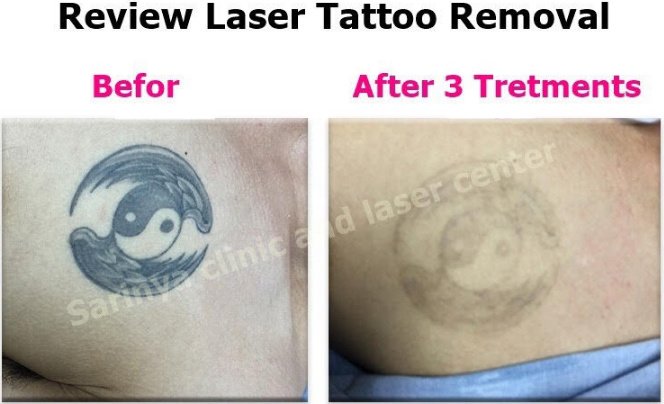 Sarinya Clinic- Chiang Mai Thailand - Sarinya Clinic- Chiang Mai Thailand