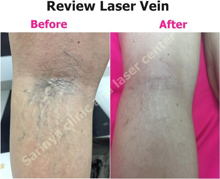 Sarinya Clinic- Chiang Mai Thailand - Sarinya Clinic- Chiang Mai Thailand