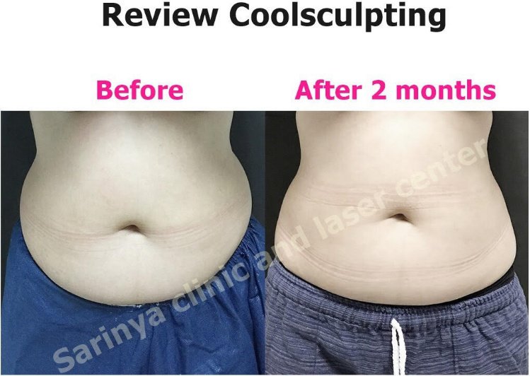 Sarinya Clinic- Chiang Mai Thailand - Sarinya Clinic- Chiang Mai Thailand