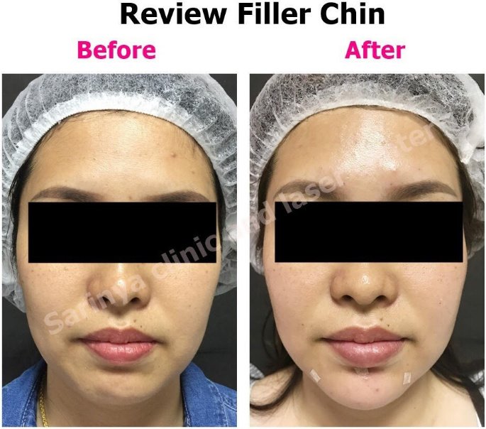 Sarinya Clinic- Chiang Mai Thailand - Sarinya Clinic- Chiang Mai Thailand