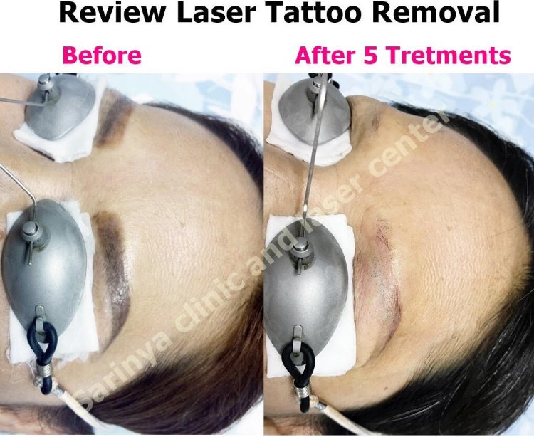 Sarinya Clinic- Chiang Mai Thailand - Sarinya Clinic- Chiang Mai Thailand