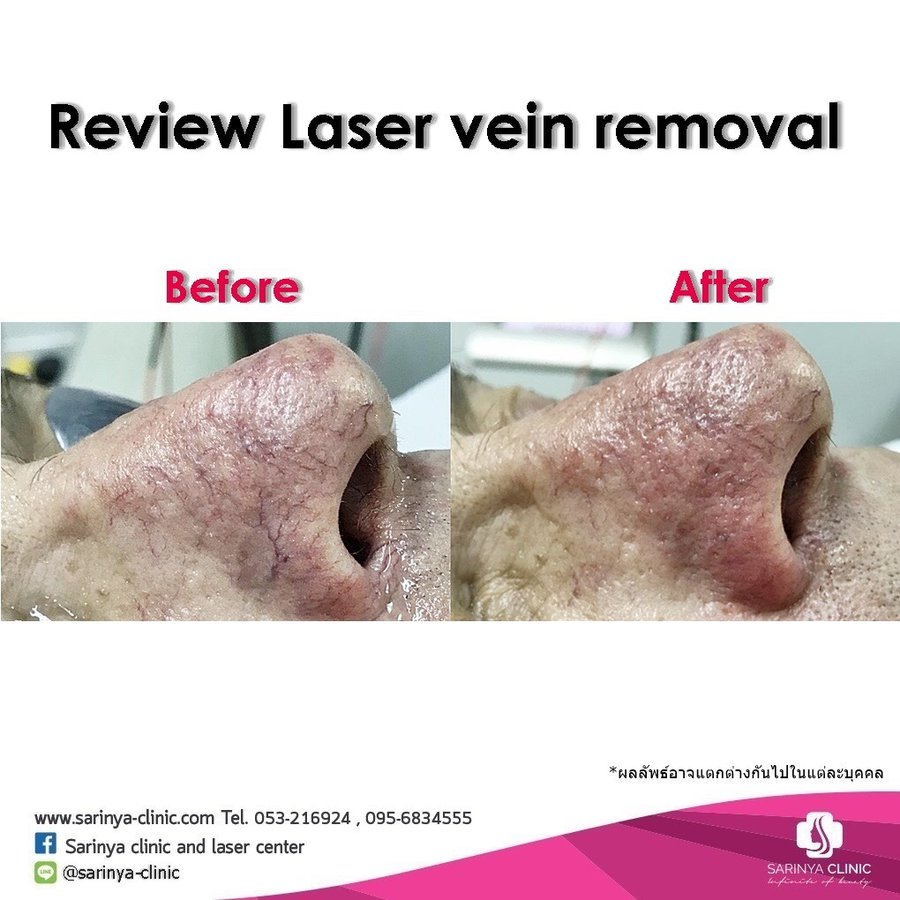 Sarinya Clinic- Chiang Mai Thailand - Sarinya Clinic- Chiang Mai Thailand