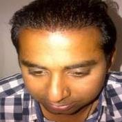 مركز ساتيام لزراعة الشعر دلهي - Satyam Hair Transplant Centre Delhi