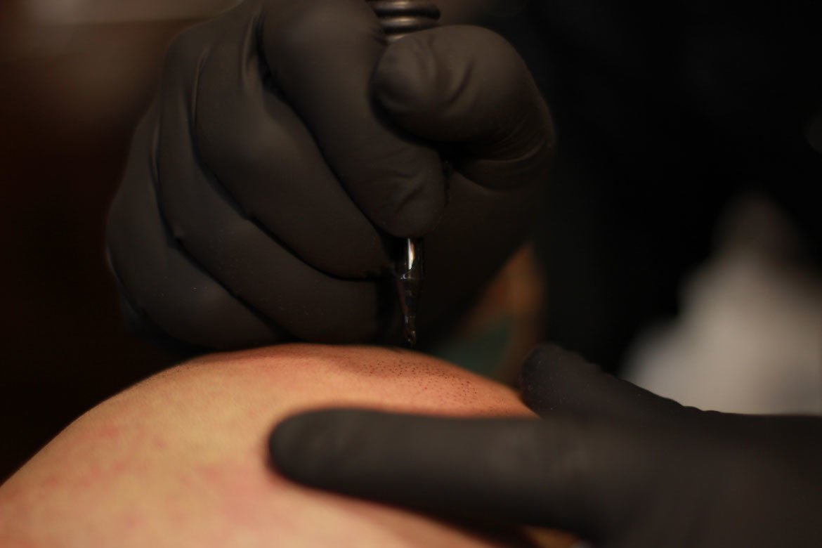 Scalp Micropigmentation Adelaide - Scalp Micropigmentation Adelaide