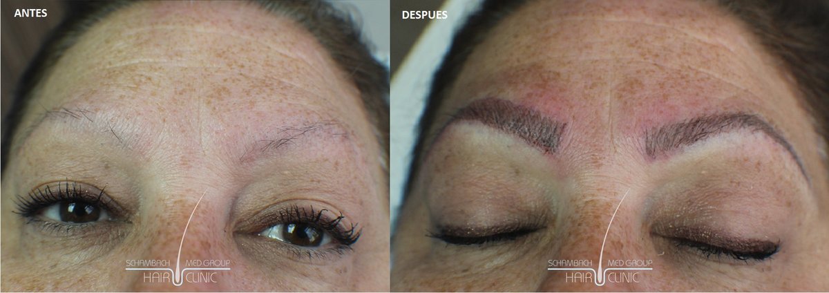 Schambach Medical Hair - Centro Clinico Capilar - Schambach Medical Hair - Centro Clinico Capilar