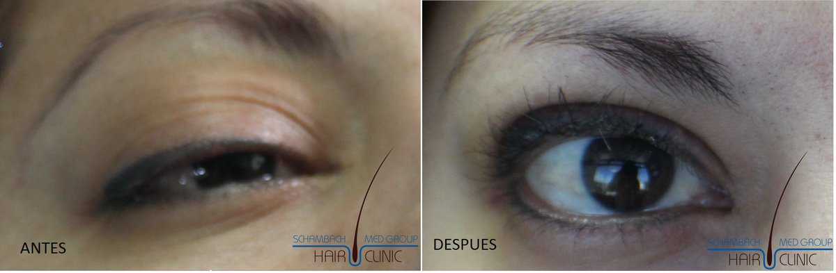 Schambach Medical Hair - Centro Clinico Capilar - Schambach Medical Hair - Centro Clinico Capilar