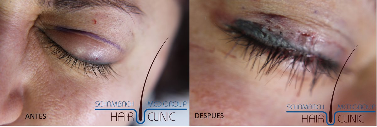 Schambach Medical Hair - Centro Clinico Capilar - Schambach Medical Hair - Centro Clinico Capilar