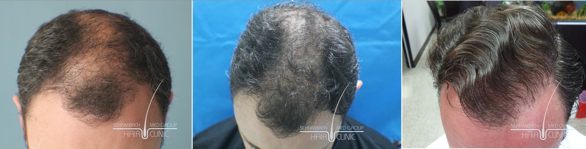 Schambach Medical Hair - Centro Clinico Capilar - Schambach Medical Hair - Centro Clinico Capilar