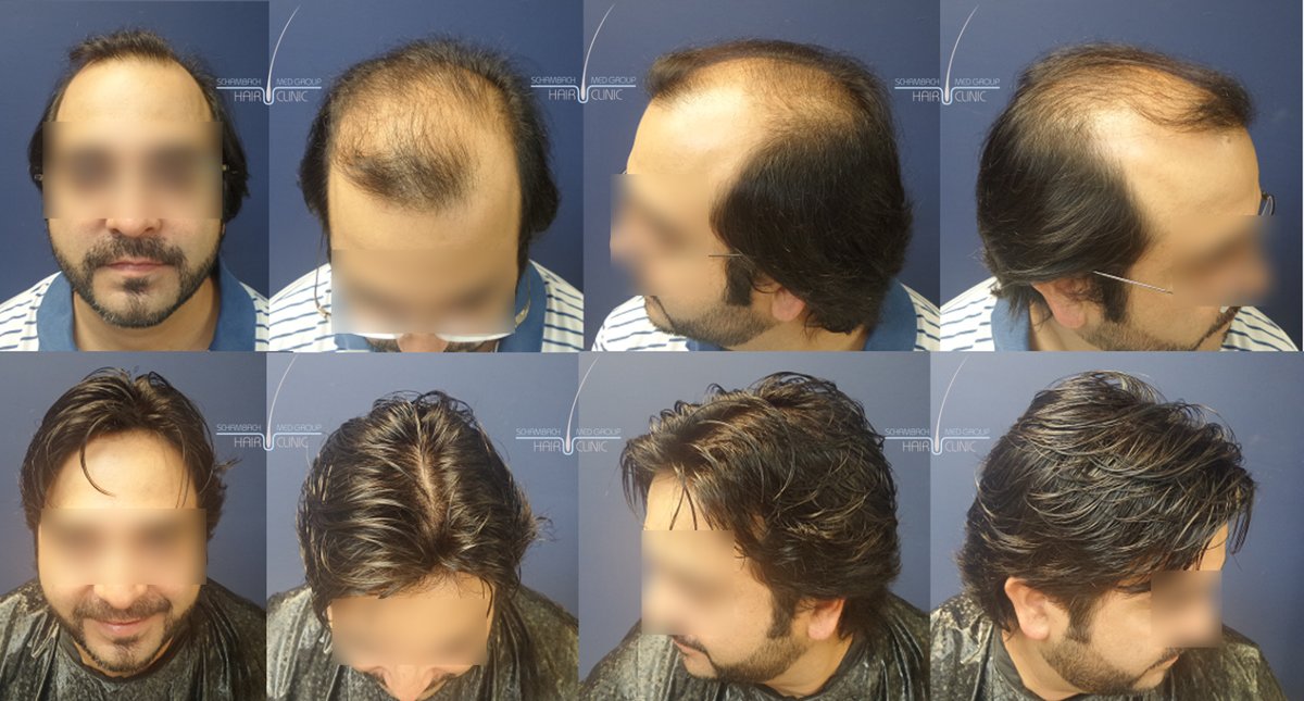 Schambach Medical Hair - Centro Clinico Capilar - Schambach Medical Hair - Centro Clinico Capilar