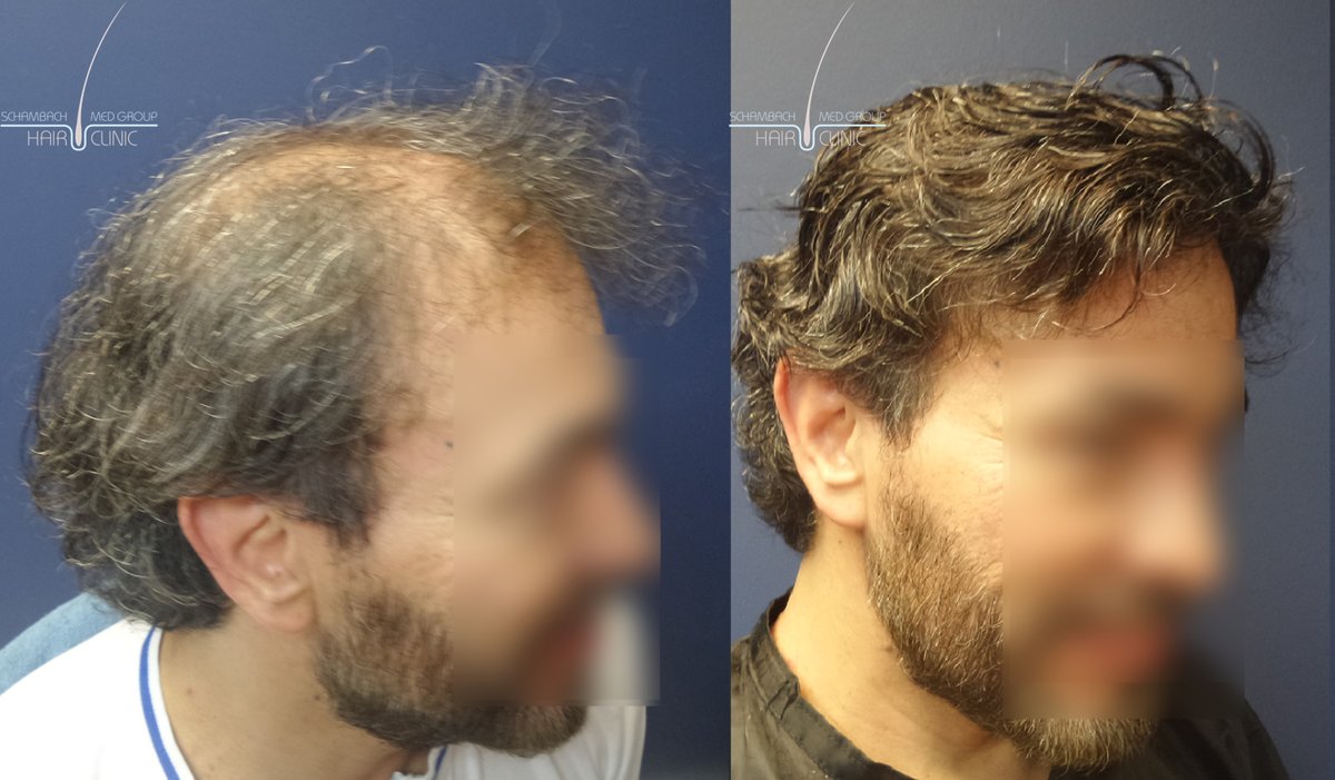 Schambach Medical Hair - Centro Clinico Capilar - Schambach Medical Hair - Centro Clinico Capilar