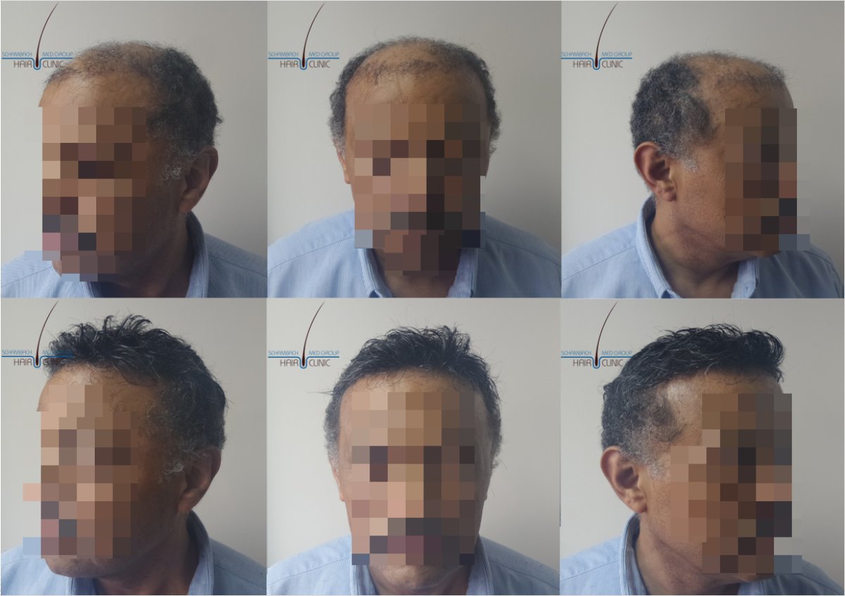 Schambach Medical Hair - Centro Clinico Capilar - Schambach Medical Hair - Centro Clinico Capilar