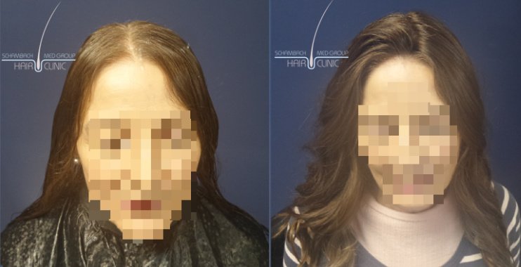 Schambach Medical Hair - Centro Clinico Capilar - Schambach Medical Hair - Centro Clinico Capilar