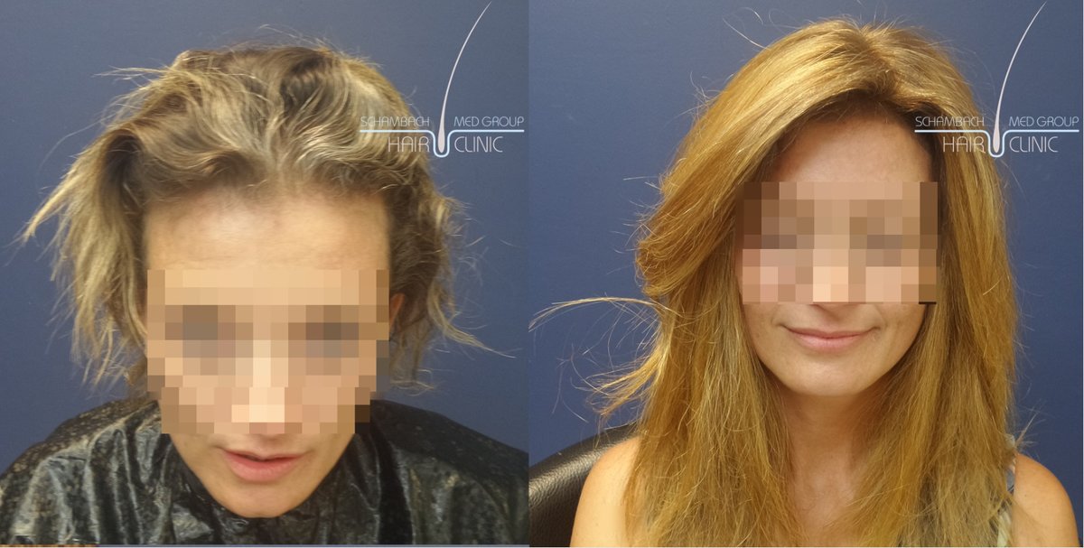 Schambach Medical Hair - Centro Clinico Capilar - Schambach Medical Hair - Centro Clinico Capilar