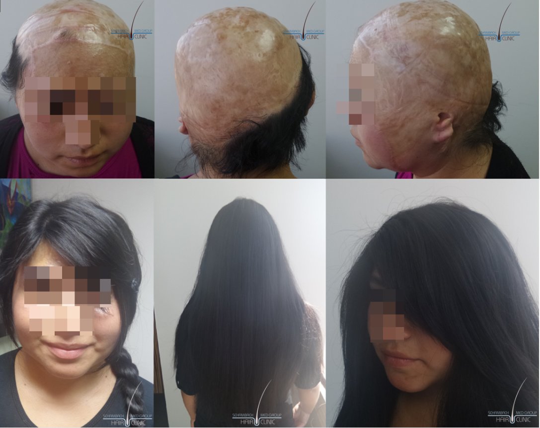 Schambach Medical Hair - Centro Clinico Capilar - Schambach Medical Hair - Centro Clinico Capilar