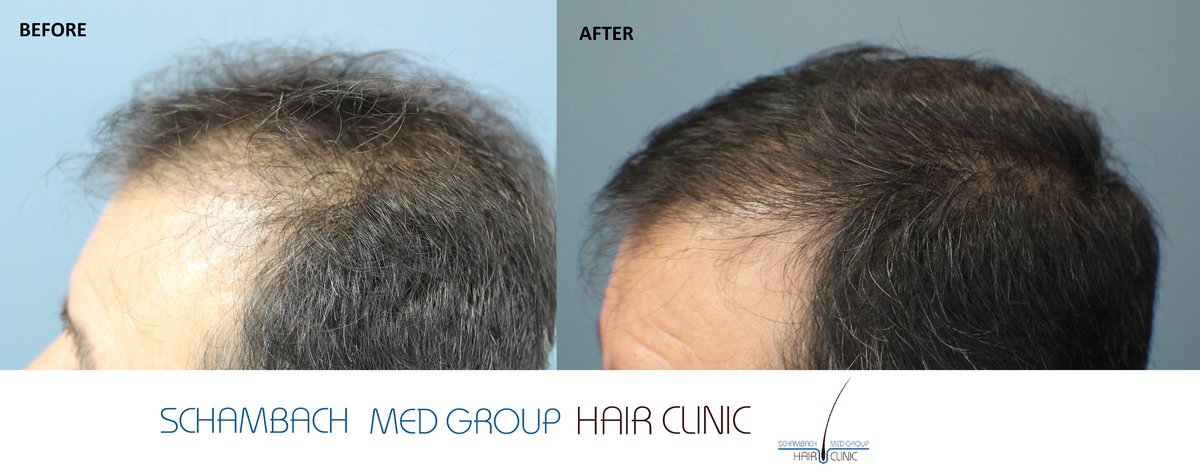 Schambach Medical Hair - Centro Clinico Capilar - Schambach Medical Hair - Centro Clinico Capilar
