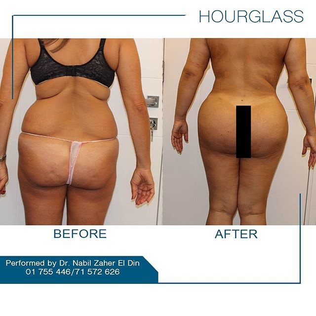 Sculpt & Smile - Sculpt & Smile
