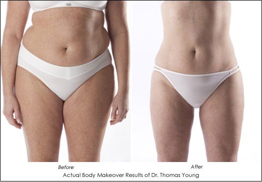 Sculpted Contours Luxury Medical Aesthetics - Sculpted Contours Luxury Medical Aesthetics